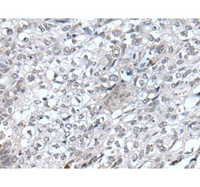 FLT4 Antibody from Signalway Antibody (43820) - Antibodies.com