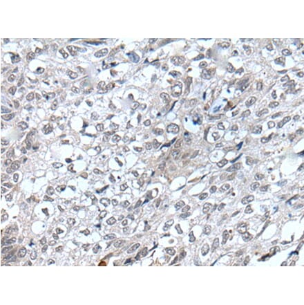 FLT4 Antibody from Signalway Antibody (43820) - Antibodies.com