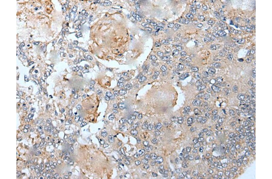 VEZT Antibody from Signalway Antibody (43821) - Antibodies.com