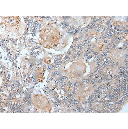 VEZT Antibody from Signalway Antibody (43821) - Antibodies.com