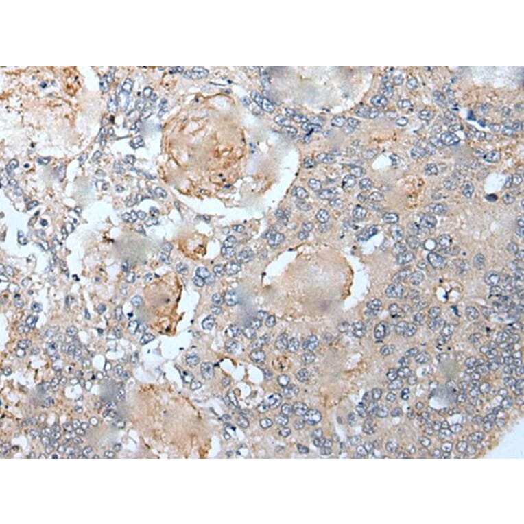 VEZT Antibody from Signalway Antibody (43821) - Antibodies.com