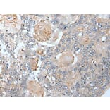 VEZT Antibody from Signalway Antibody (43821) - Antibodies.com