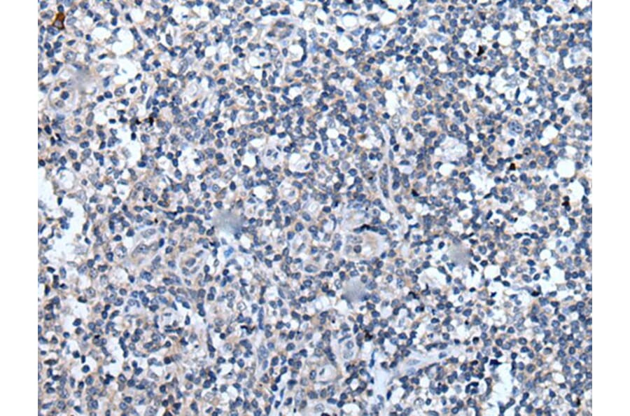 VEZT Antibody from Signalway Antibody (43821) - Antibodies.com