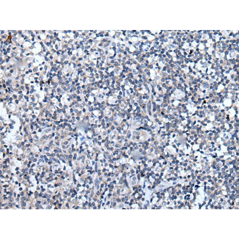 VEZT Antibody from Signalway Antibody (43821) - Antibodies.com