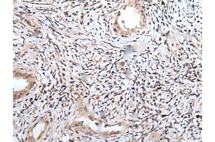 UBN1 Antibody from Signalway Antibody (43829) - Antibodies.com