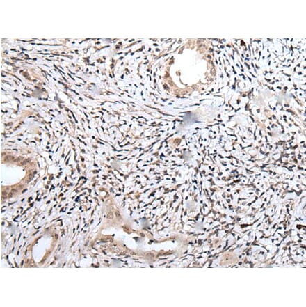 UBN1 Antibody from Signalway Antibody (43829) - Antibodies.com