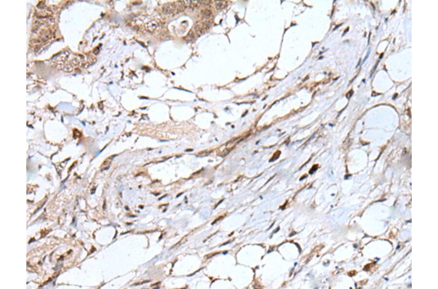 UBN1 Antibody from Signalway Antibody (43829) - Antibodies.com