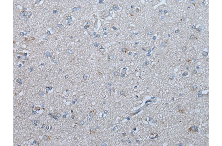 UBR4 Antibody from Signalway Antibody (43830) - Antibodies.com