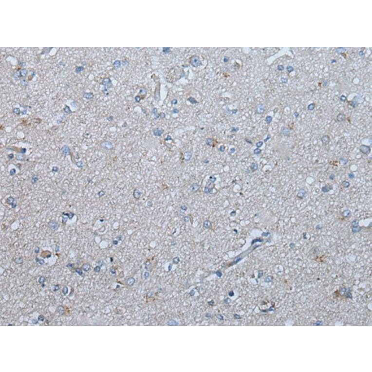 UBR4 Antibody from Signalway Antibody (43830) - Antibodies.com