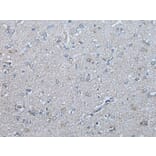 UBR4 Antibody from Signalway Antibody (43830) - Antibodies.com