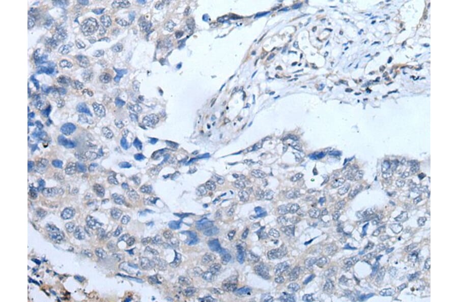 UBR4 Antibody from Signalway Antibody (43830) - Antibodies.com