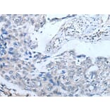 UBR4 Antibody from Signalway Antibody (43830) - Antibodies.com