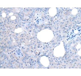 UCK2 Antibody from Signalway Antibody (43831) - Antibodies.com