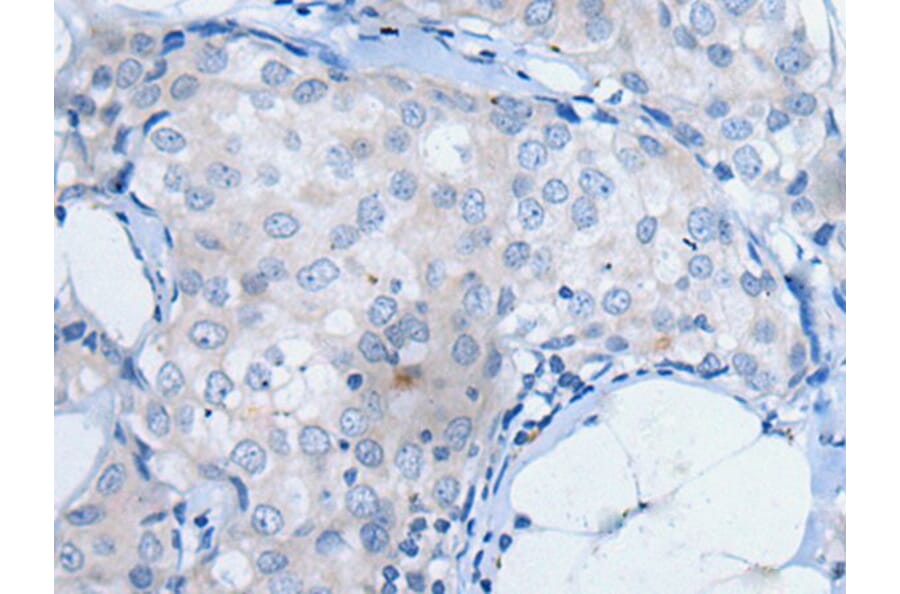 UCK2 Antibody from Signalway Antibody (43831) - Antibodies.com