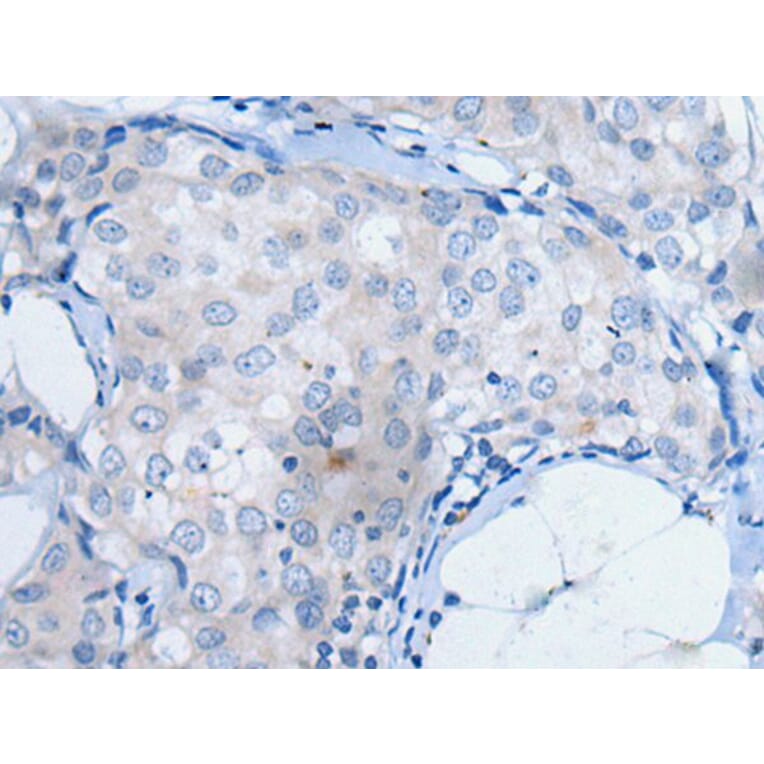 UCK2 Antibody from Signalway Antibody (43831) - Antibodies.com