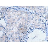 UCK2 Antibody from Signalway Antibody (43831) - Antibodies.com