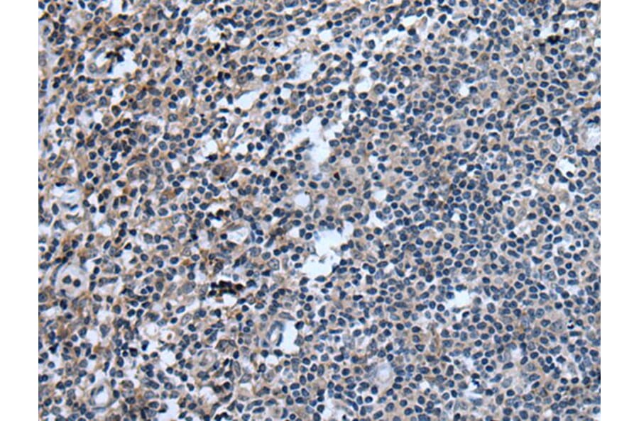 UGT8 Antibody from Signalway Antibody (43836) - Antibodies.com