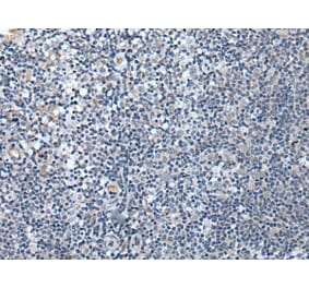 SPTB Antibody from Signalway Antibody (43844) - Antibodies.com
