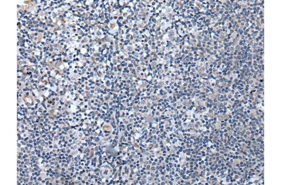 SPTB Antibody from Signalway Antibody (43844) - Antibodies.com