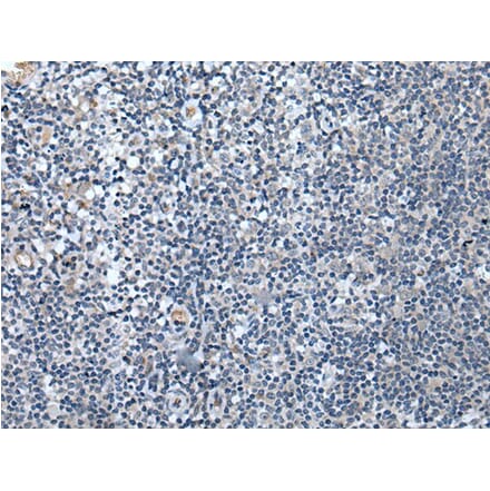 SPTB Antibody from Signalway Antibody (43844) - Antibodies.com