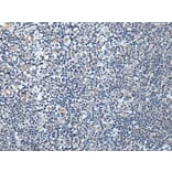SPTB Antibody from Signalway Antibody (43844) - Antibodies.com