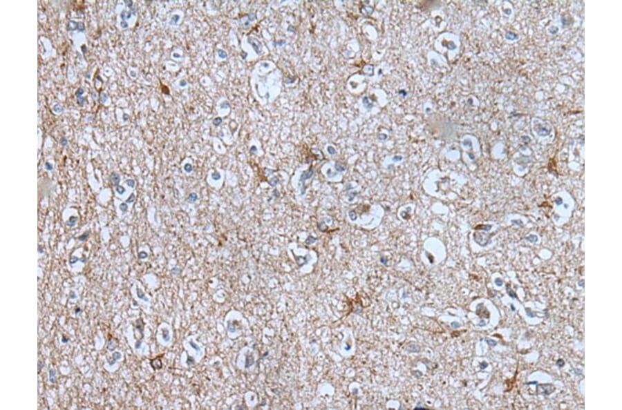 BMP1 Antibody from Signalway Antibody (43850) - Antibodies.com