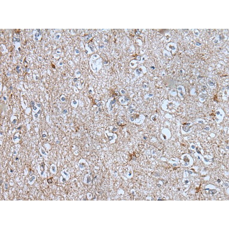 BMP1 Antibody from Signalway Antibody (43850) - Antibodies.com