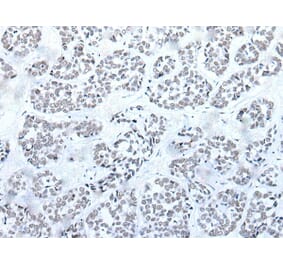 BRD3 Antibody from Signalway Antibody (43853) - Antibodies.com