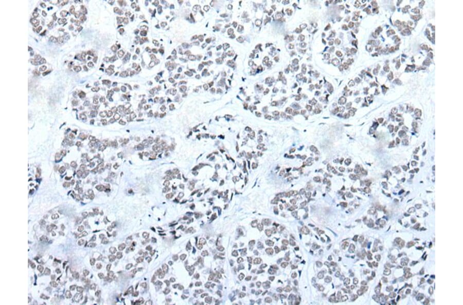 BRD3 Antibody from Signalway Antibody (43853) - Antibodies.com