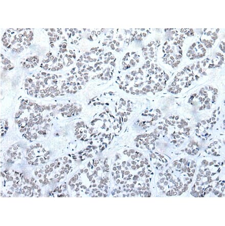 BRD3 Antibody from Signalway Antibody (43853) - Antibodies.com