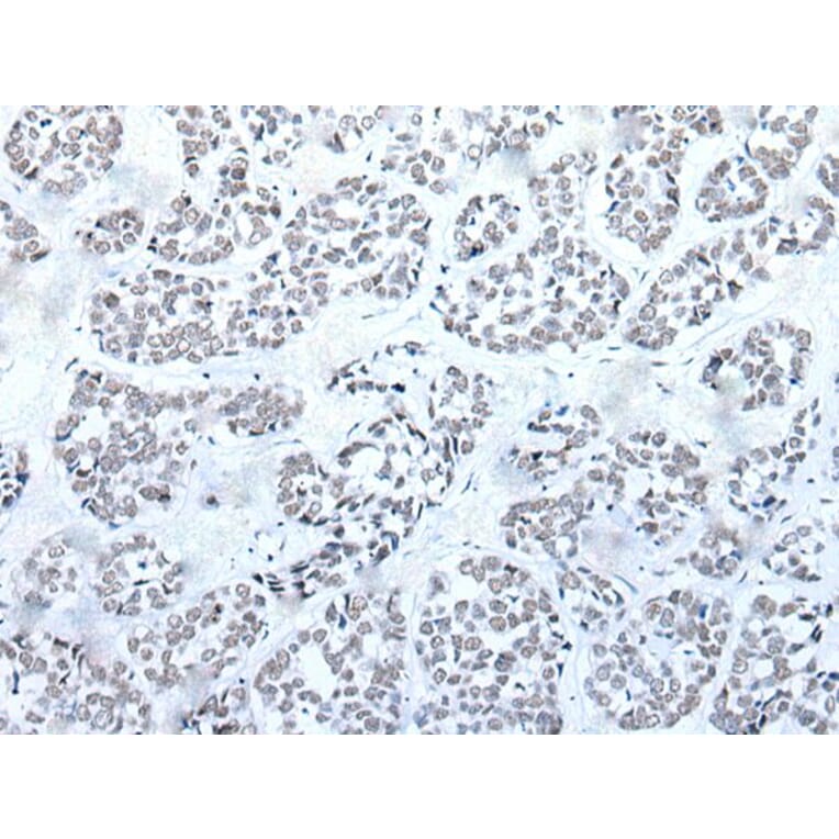 BRD3 Antibody from Signalway Antibody (43853) - Antibodies.com