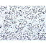 BRD3 Antibody from Signalway Antibody (43853) - Antibodies.com
