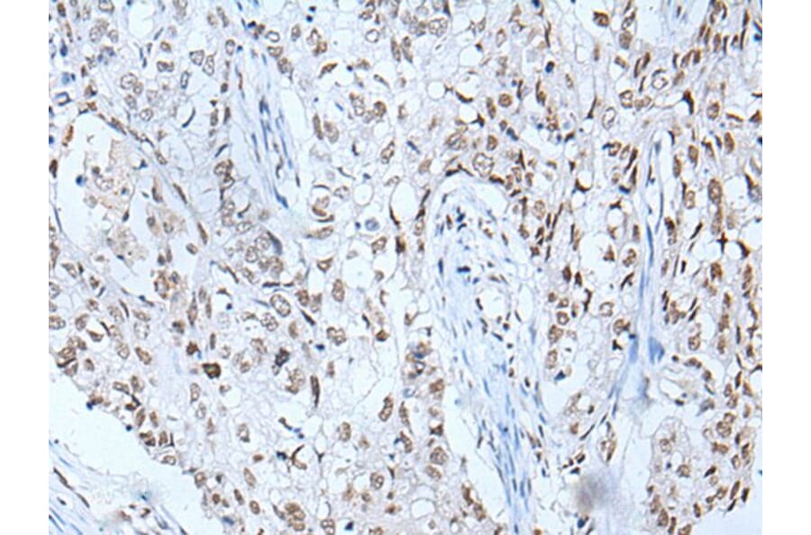 BRD3 Antibody from Signalway Antibody (43853) - Antibodies.com