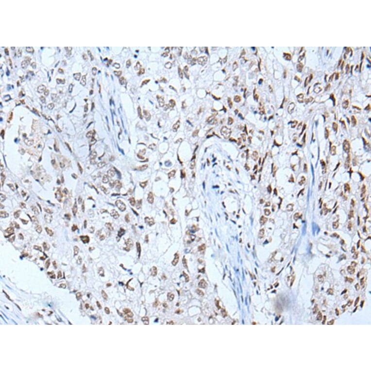 BRD3 Antibody from Signalway Antibody (43853) - Antibodies.com