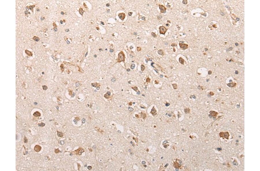 SFR1 Antibody from Signalway Antibody (43861) - Antibodies.com