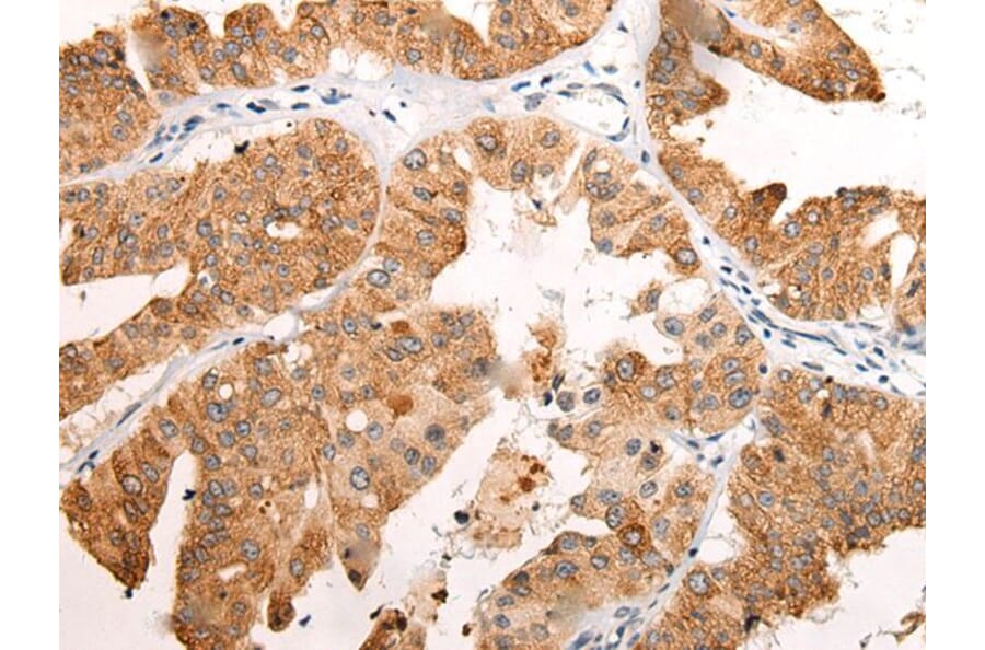 EMC7 Antibody from Signalway Antibody (43869) - Antibodies.com