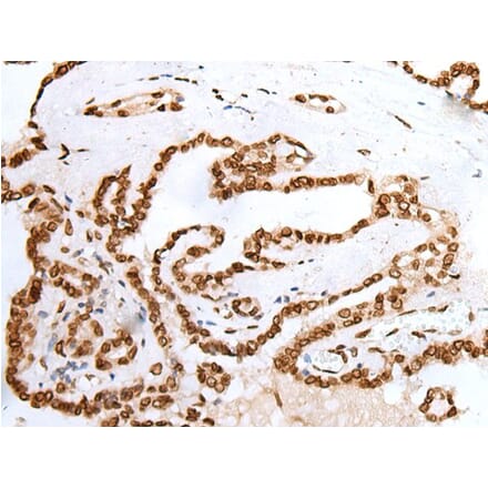 PIF1 Antibody from Signalway Antibody (43903) - Antibodies.com