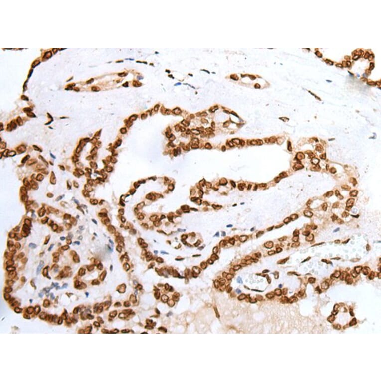 PIF1 Antibody from Signalway Antibody (43903) - Antibodies.com