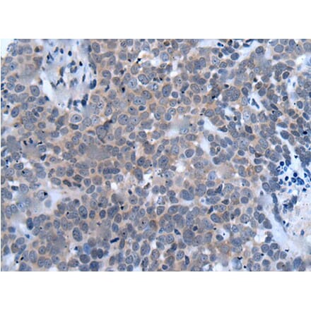 HES1 Antibody from Signalway Antibody (43905) - Antibodies.com