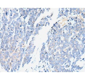 SMC2 Antibody from Signalway Antibody (43911) - Antibodies.com