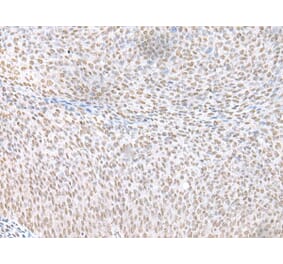 ECT2 Antibody from Signalway Antibody (43917) - Antibodies.com