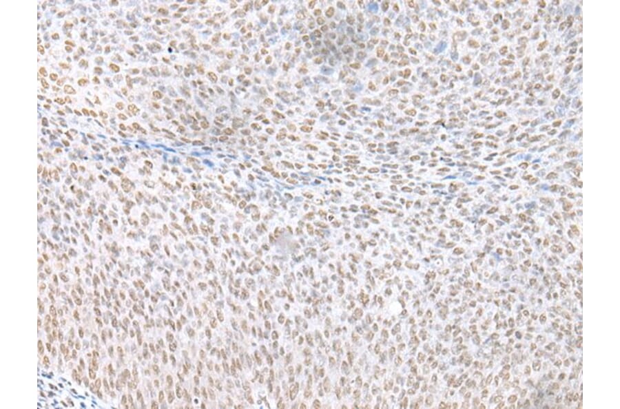 ECT2 Antibody from Signalway Antibody (43917) - Antibodies.com