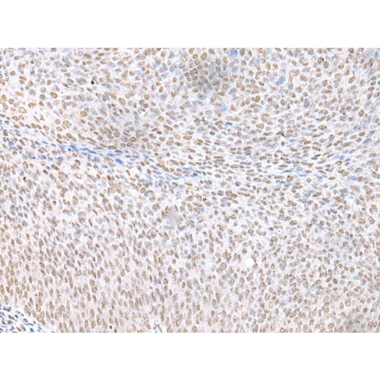 ECT2 Antibody from Signalway Antibody (43917) - Antibodies.com