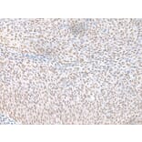 ECT2 Antibody from Signalway Antibody (43917) - Antibodies.com