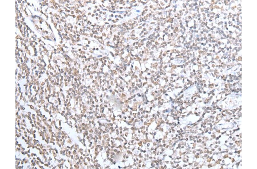 ECT2 Antibody from Signalway Antibody (43917) - Antibodies.com