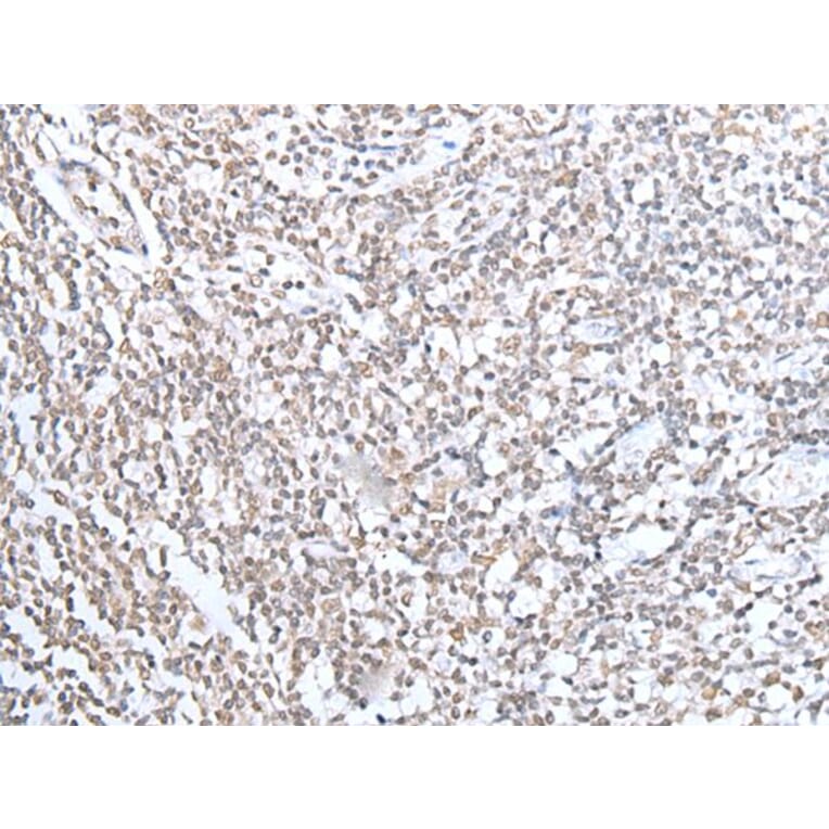 ECT2 Antibody from Signalway Antibody (43917) - Antibodies.com