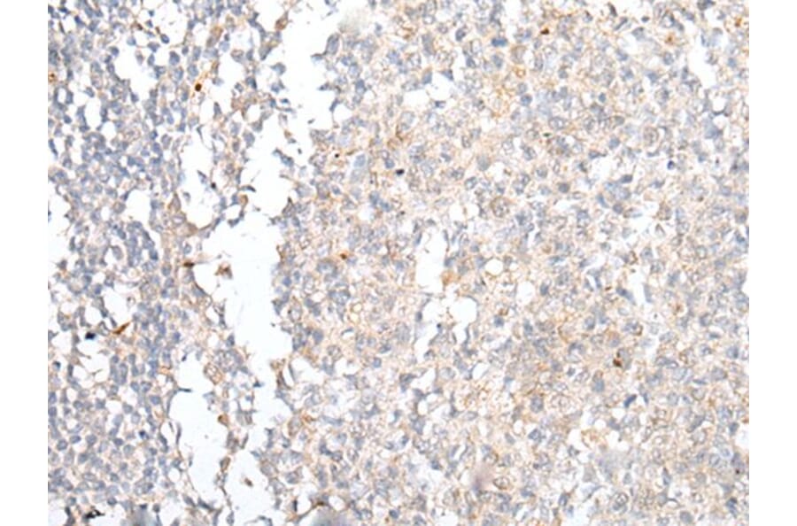 CCR4 Antibody from Signalway Antibody (43918) - Antibodies.com