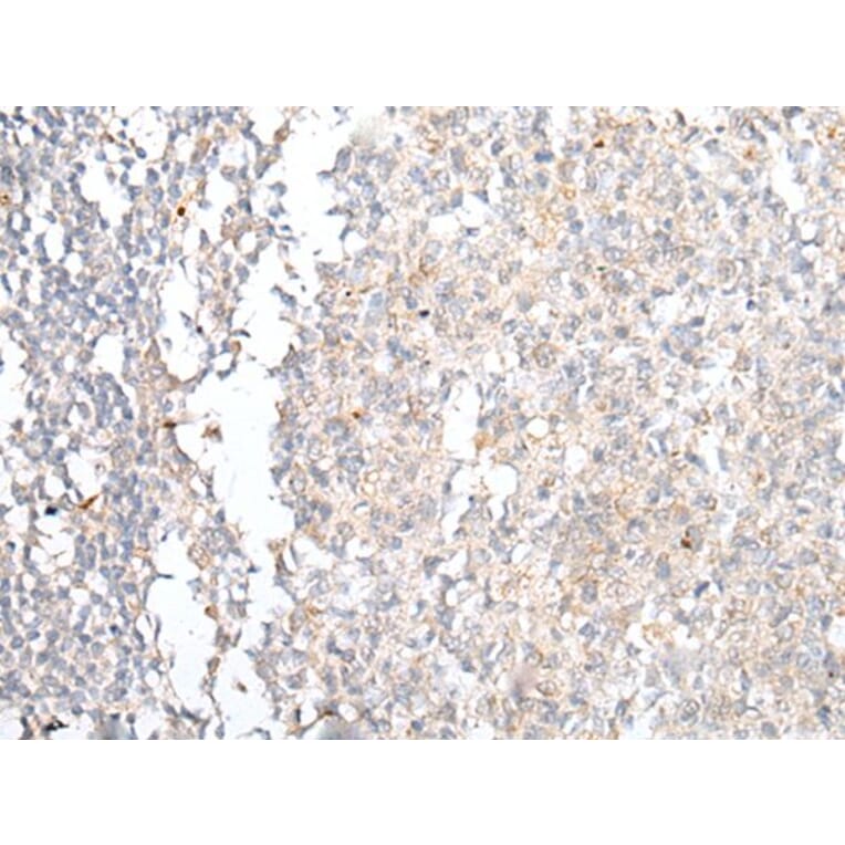 CCR4 Antibody from Signalway Antibody (43918) - Antibodies.com