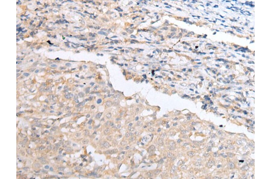 CCR4 Antibody from Signalway Antibody (43918) - Antibodies.com