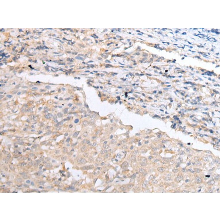 CCR4 Antibody from Signalway Antibody (43918) - Antibodies.com